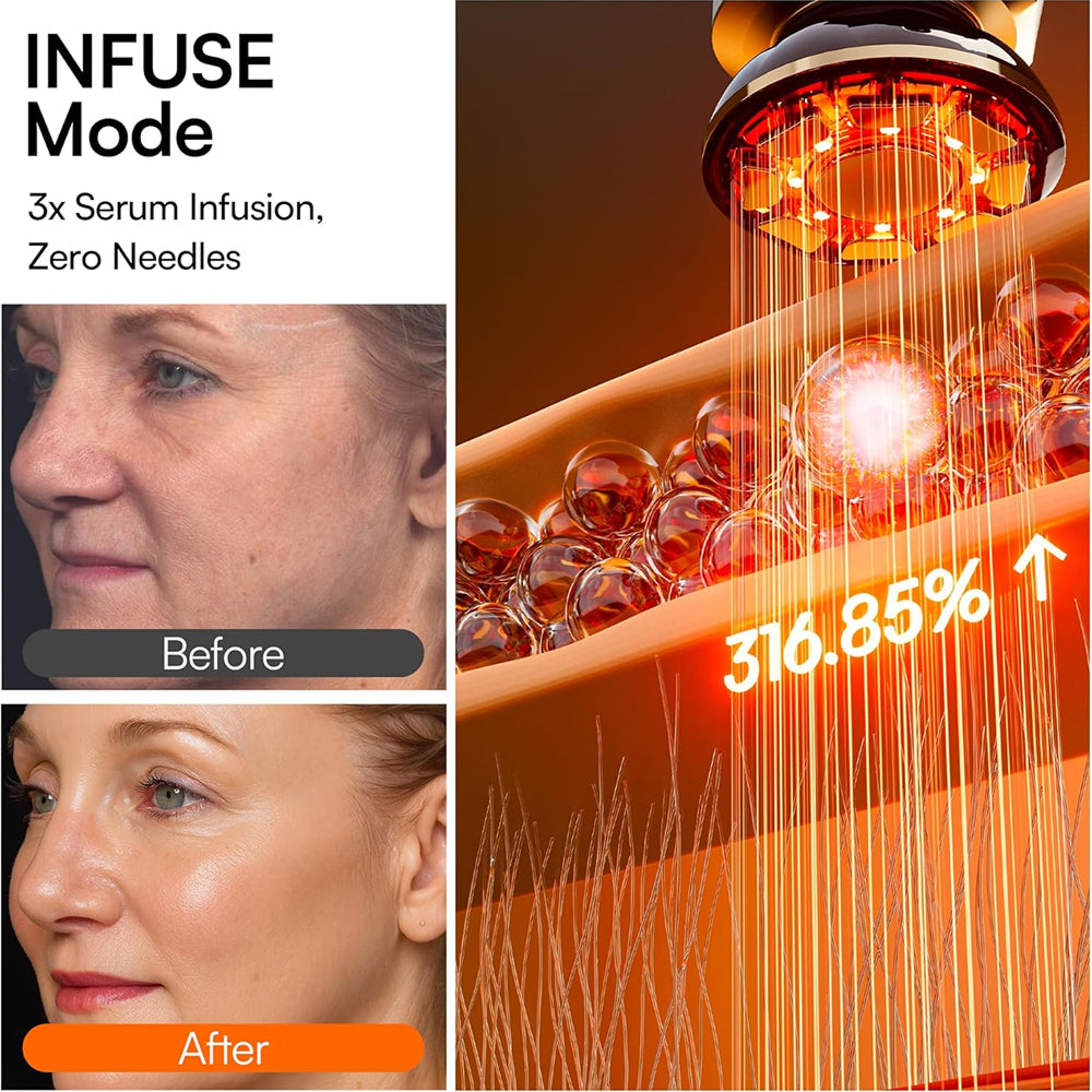 Promotional graphic for MioPulsex Microcurrent Device showing a before-and-after face comparison on the left and a close-up of a glowing orange device with text reading 'INFUSE Mode', '3x Serum Infusion, Zero Needles', and '316.85%'.