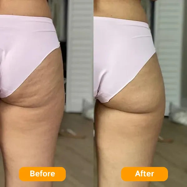 Svelora Cellulite Massager feature overview