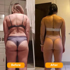 Svelora Cellulite Massager product display